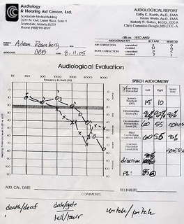 audiology hearing test chart