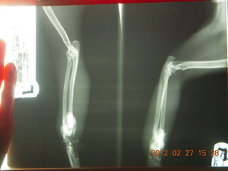 Maria's X-ray