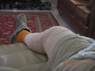 9 9f2. after knee operation