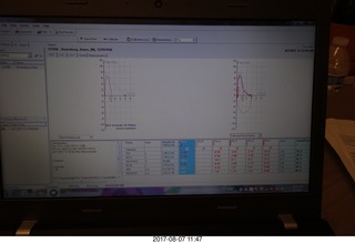 breath test results