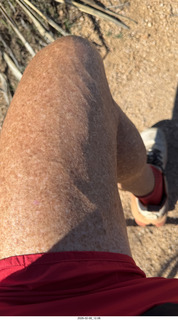 Scottsdale - Granite Mountain Hike - my veined leg